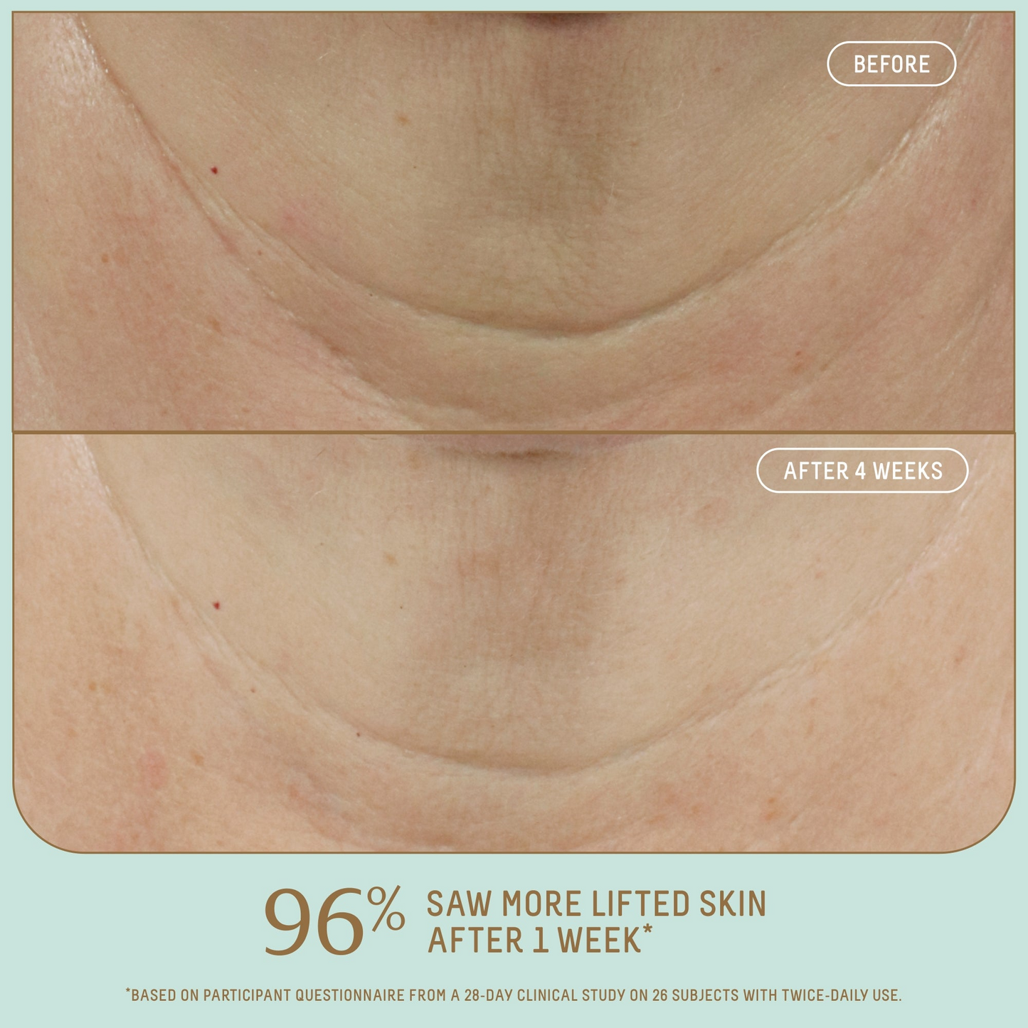 Squalane + Firm and Lift Dual Serum