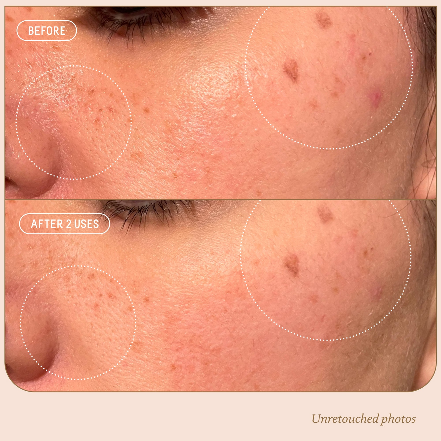 Squalane + 10% Azelaic Pore Minimizing Mask